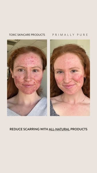 Ad by Ben Corkery Founder at The Tallowed Truth