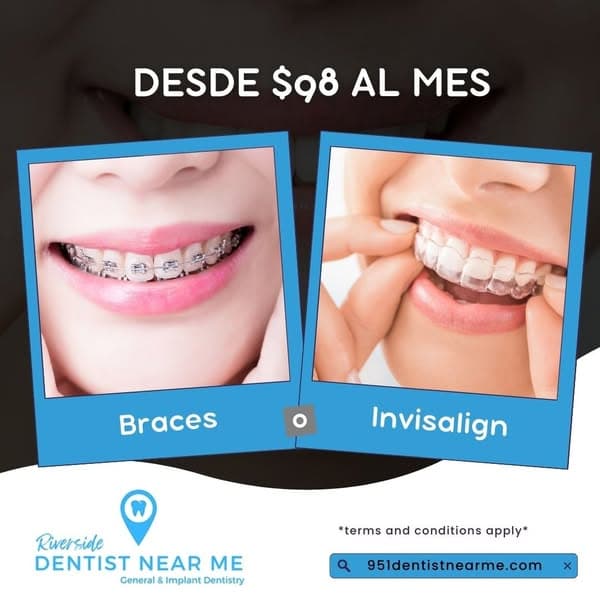 Ad by Dental Benefits Finder
