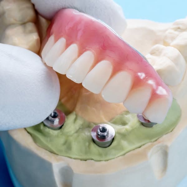 Ad by Dentist Near Me Riverside