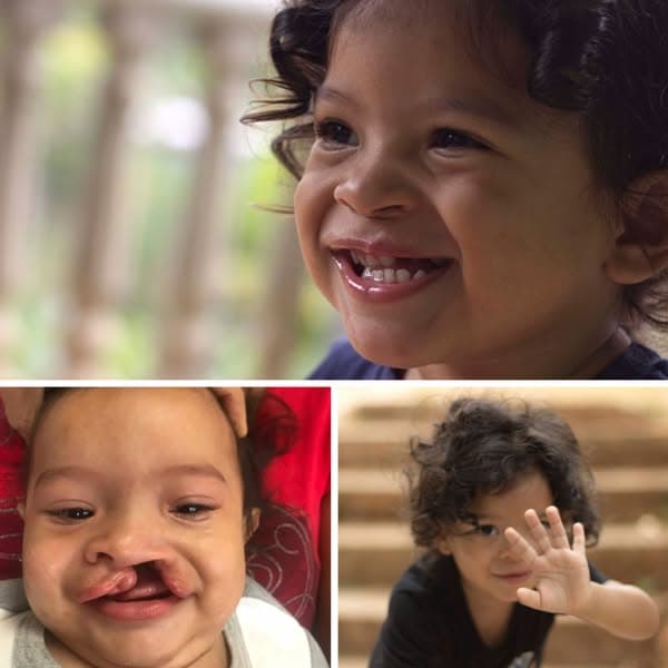 Ad by Smile Train